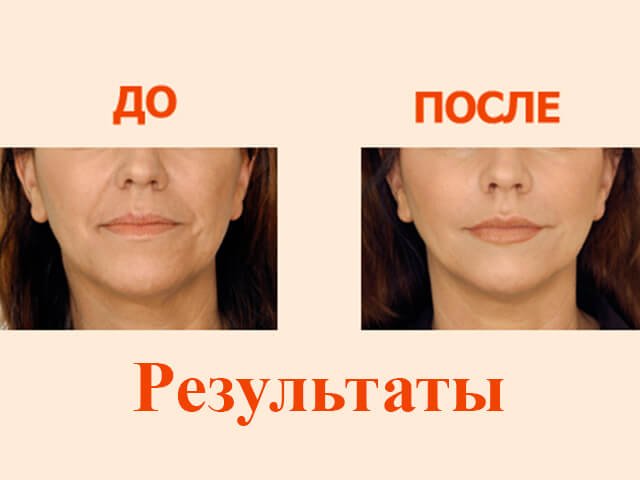 Відновлення форми губ у літніх людей