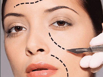 Мініліпоакція як метод коригування овалу обличчя