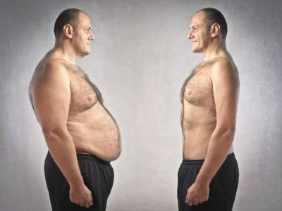 Операція зі зрізання жиру з живота