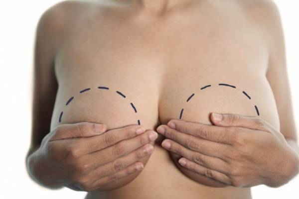 Показання до проведення Періареолярний мастопексії