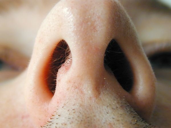 Викривлена ​​носова перегородка